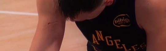 开云体育-谁抓的~东契奇罚球时看向手臂 好几道伤口&amp;血迹斑斑