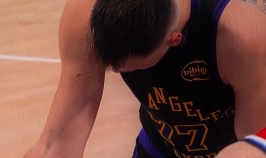 开云体育-谁抓的~东契奇罚球时看向手臂 好几道伤口&amp;血迹斑斑